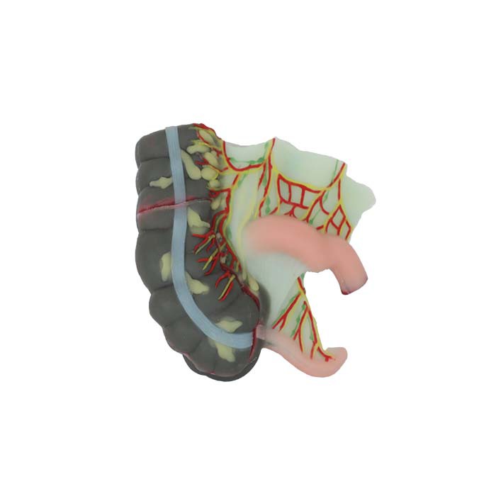 Cecum And Appendix Soft Silicone Anatomy Model